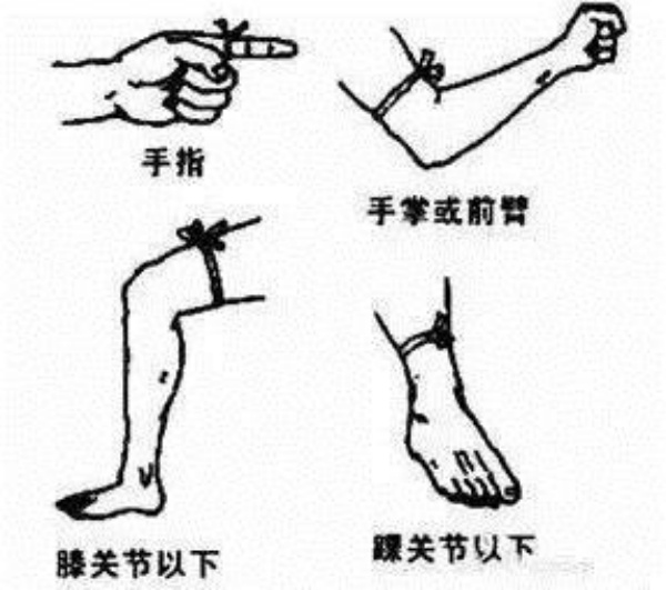 包扎伤口指引。_副本.jpg